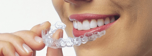 Clear or Invisible Teeth Braces
